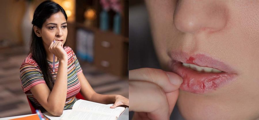 Skin-Picking Is A Legit Disorder Called Dermatillomania