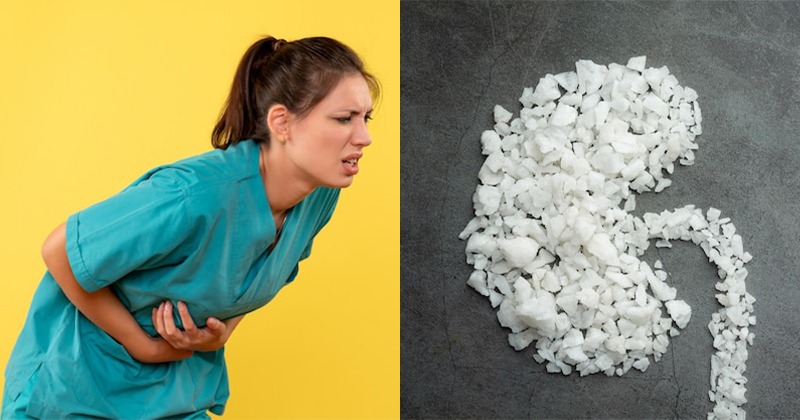 Kidney Stone Causes In Feline Obstructive Nephropathy Reference: क डन स ट न क द क कत ह